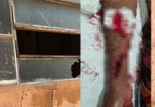 Homem fica gravemente ferido após quebrar vidro com soco durante surto em Três Lagoas