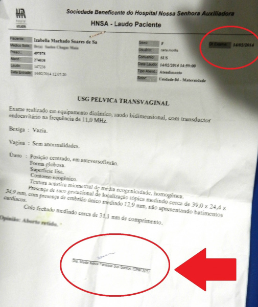 O exame feito pela paciente no dia 14/02/2014 foi pedido por outra profissional mas quem assinou e realizou a curetagem foi a médica afastada.