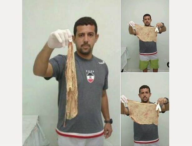 Erivaldo Veloso, marido de Thamara Macedo, mostra tampão esquecido no corpo da mulher após o parto