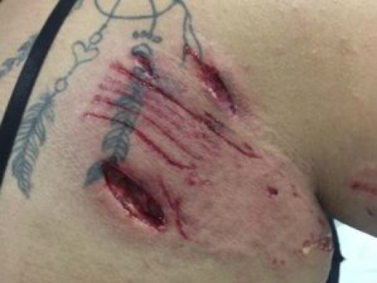 Jovem sofreu vários ferimentos (Foto: direto das ruas)