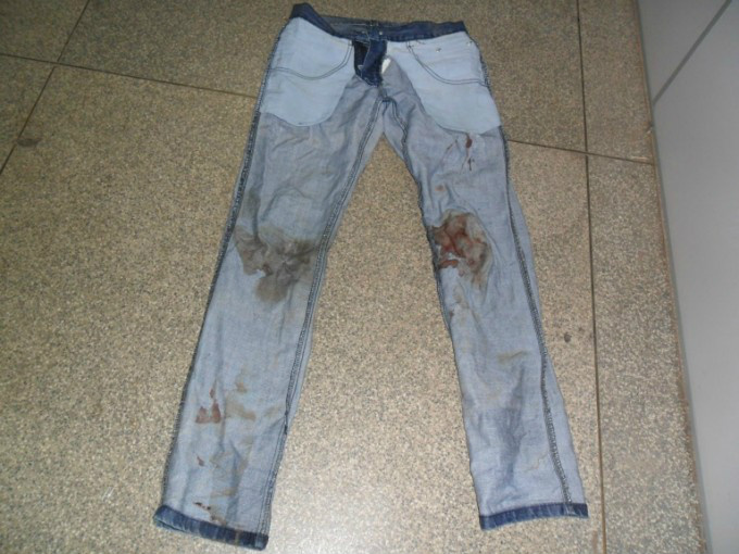 Roupa toda ensanguentada.Foto:Rádio Caçula