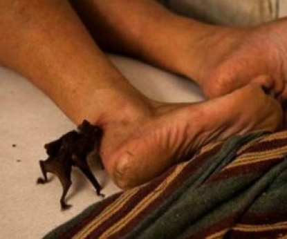 Vítima acidentalmente, pisou em um morcego, que mordeu o pé dele. - Foto: Divulgação