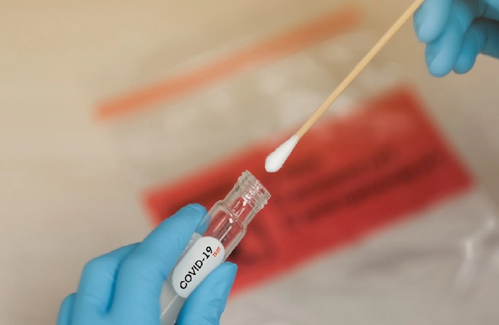 Imagem ilustrativa de teste PCR. Foto: Horth Rasur/Shutterstock.