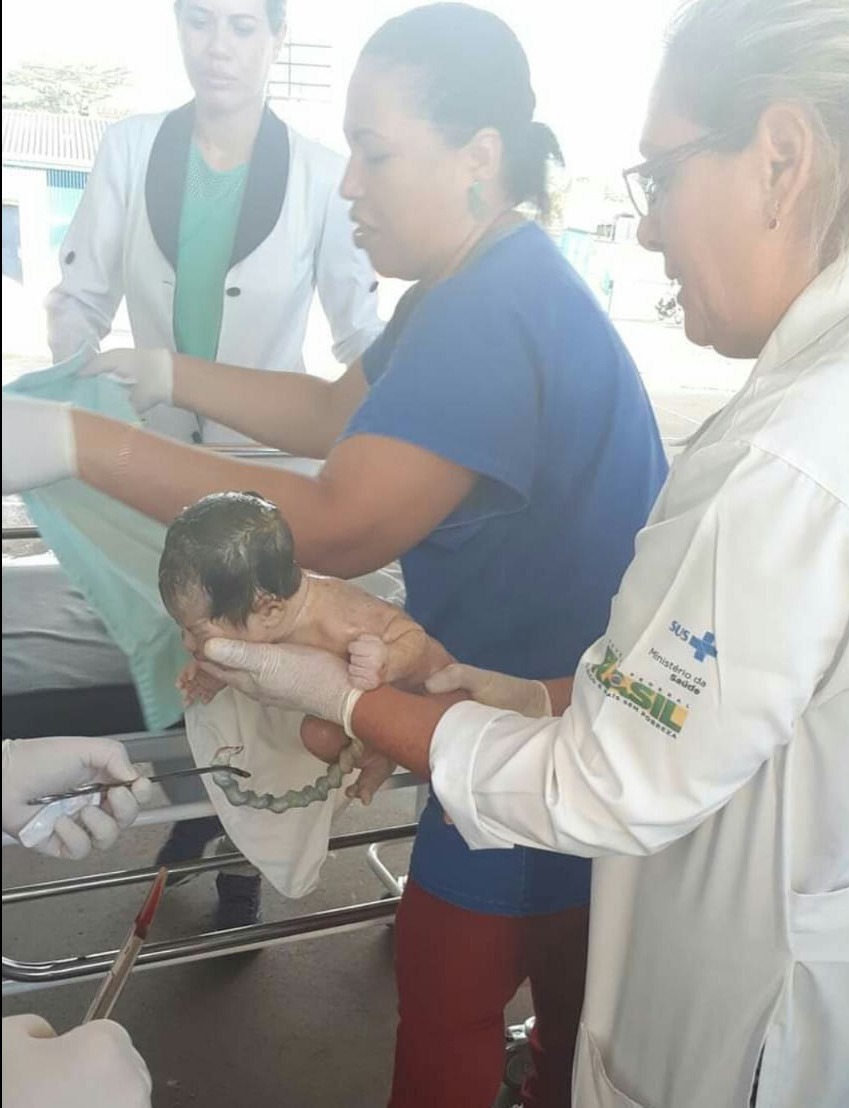 Criança sendo socorrida por equipe da UPA - Foto: Divulgação/ Sesau