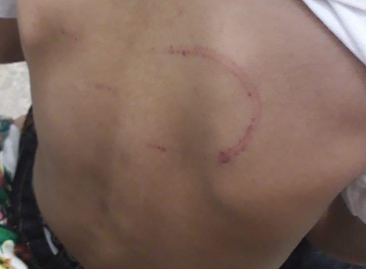A criança foi encaminhada ao hospital e Chapadão do Sul (MS). Foto: Polícia Civil.