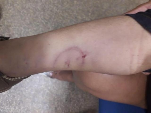 Várias marcas de espancamento forma localizadas no corpo da criança (Foto: divulgação/Polícia Civil)