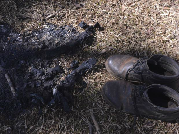 O morador de rua respira sob ajuda de aparelhos após ter o corpo carbonizado enquanto dormia em uma rua no DF.Foto: G1