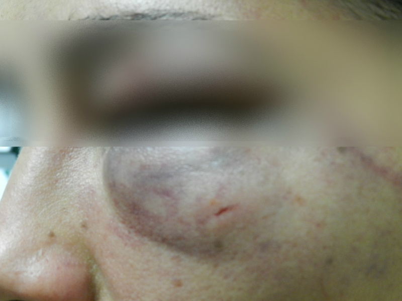 Foto: Rádio Caçula