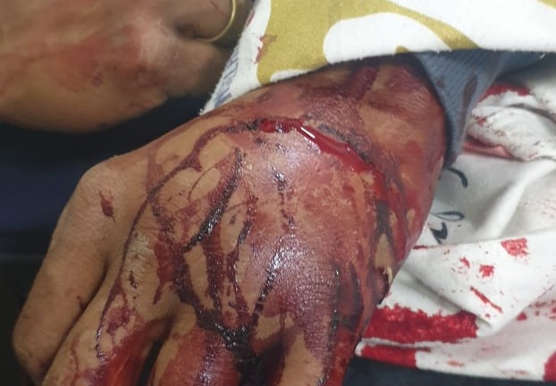 Foto: Polícia Militar.