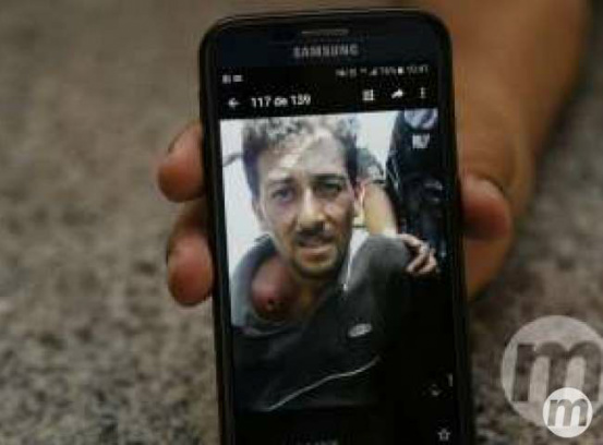 Mariano Tardeli, brasileiro, foi ferido no confronto com a polícia boliviana