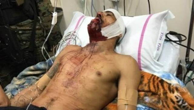 De acordo com o site paraguaio ABC Color, Sérgio está internado no hospital Metropolitano, da cidade Fernando de la Mora. Ele foi baleado pelos seguranças de Rafaat durante a emboscada e abandonado pelos colegas no hospital paraguaio, onde está sob escolta para Polícia Nacional Paraguaia.Nesta sexta-feira (24), outros dois suspeitos de participação no ataque a Rafaat foram presos na região de Pedro Juan Caballero. O brasileiro Renato Signoretti, 36, residente de Ponta Porã, e o paraguaio Mario Sergio Amaral Flores, 42, estavam em um Golf branco, usado para levar Sérgio ao hospital de Pedro Juan.Ataque - Rafaat era considerado o “Rei da Fronteira” e foi executado em uma ação cinematográfica, com a participação de cerca de 100 pistoleiros contratados para matá-lo. Do lado da vítima, 30 seguranças tentaram combater a ação dos pistoleiros.A caminhonete Hummer blindada dirigida pelo narcotraficante foi interceptada em um cruzamento de Pedro Juan Caballero, quando ele retornava para casa à noite. Um utilitário que tinha na parte traseira uma metralhadora .50, passou à frente e o atirador, o brasileiro Sérgio Lima dos Santos, descarregou uma “cinta” de munição.A vítima morreu no local. O atirador acabou sendo baleado, levado por integrantes da quadrilha para o hospital de Pedro Juan Caballero e posteriormente transferido para unidade de saúde de Assunção, por causa da gravidade do seu quadro clínico. O motorista do carro desapareceu.