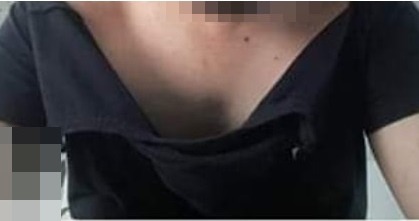 De acordo com o profissional, as agressões fizeram com que sua camiseta ficasse rasgada, sua corrente arrebentada e o seu óculos quebrado. Foto: Arquivo pessoal.