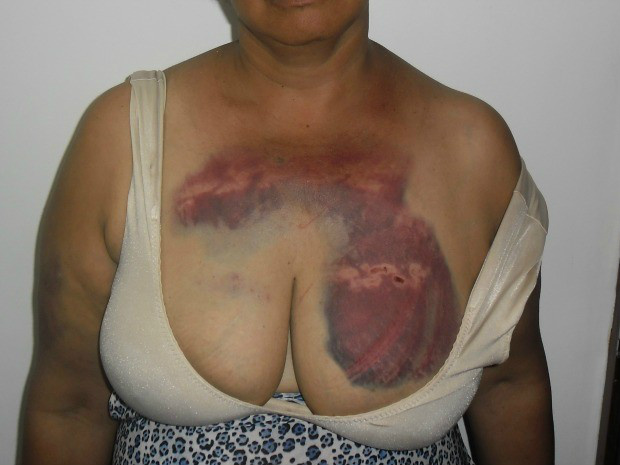 Vítima foi ferida com correntes e agredida verbalmente por suspeito (Foto: Graziela Rezende/G1 MS)