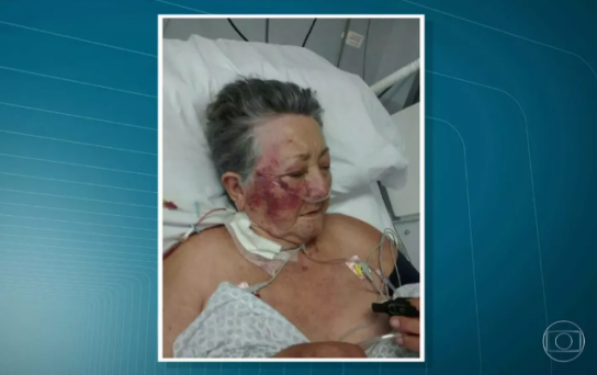 Idosa foi agredida na UTI por enfermeiro em SP (Foto: Reprodução/TV Globo)