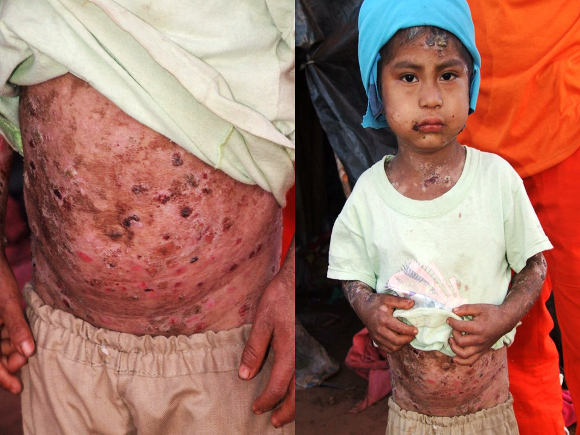 Família refugiada do Paraguai sobrevive com doações.Foto: Divulgação