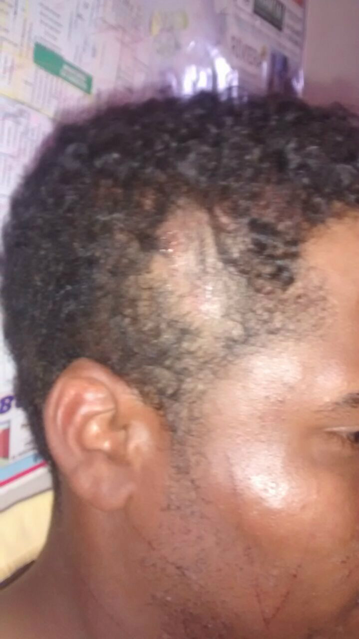 Homem de 26 abandonado na BR-158 (Créditos Alvarez Jr)