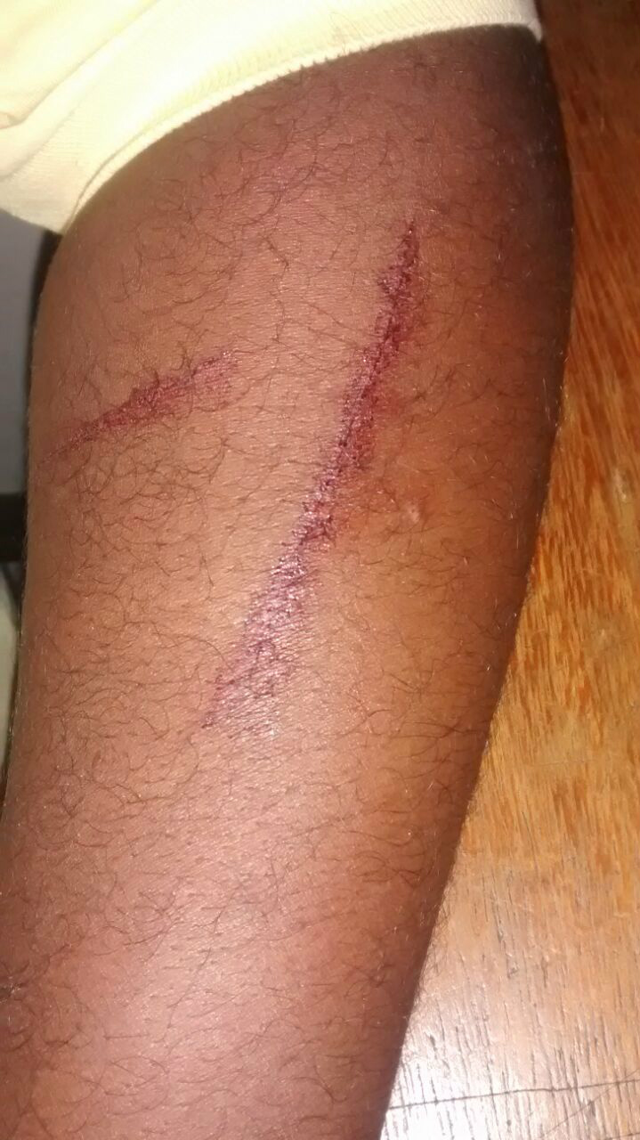 Cortes foram feitos com pedaços de caco de vidro (Créditos: Alvarez Jr.)