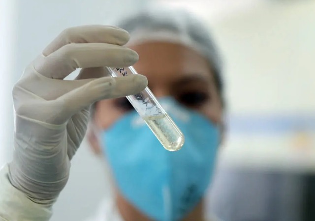 Procedimento de teste de microbacteria no Instituto Adolpho Lutz, referência no diagnóstico laboratorial de tuberculose em SP; registro da doença triplicou em dez anos (20/02/2017) Foto: Werther Santana/Estadão