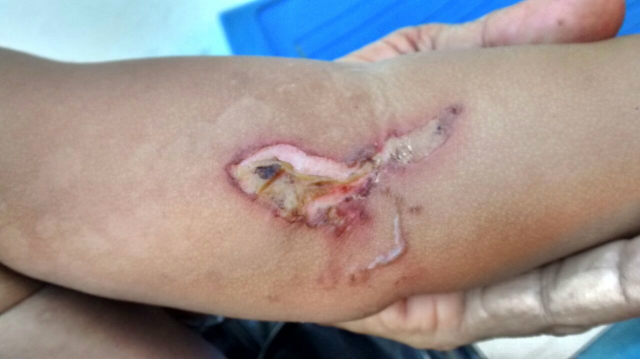 Bebê de um ano sofria violência doméstica. Mãe 