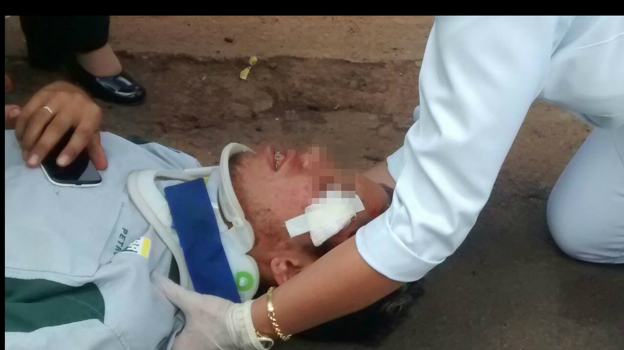 Jovem com corte no supercílio (Foto Rádio Caçula)