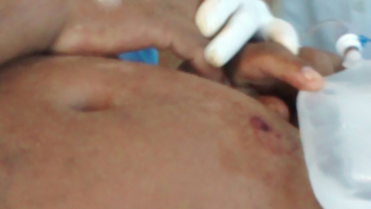 Nilson Ferreira de Azevedo, de 43 anos foi alvejado a queima roupa na região do abdômen. Foto: Rádio Caçula