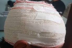 Cego de ciúmes homem se esconde em matagal à espera de sua vítima e o agride a pauladas. Foto: arquivo pessoal.