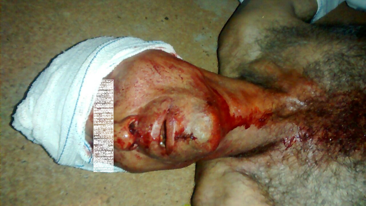 Italiba José Pedro Junior, de 46 anos brutalmente agredido  pelo sobrinho neste domino (1). Foto: Rádio Caçula