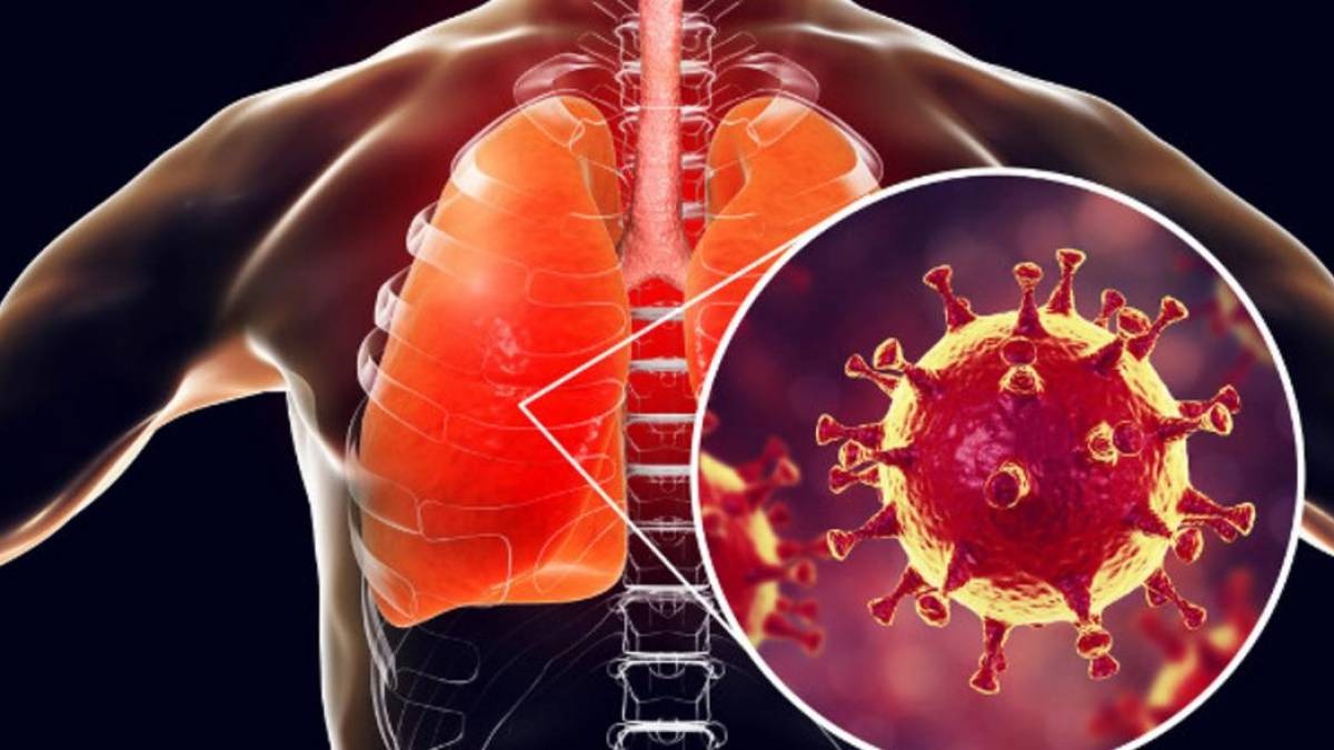 Pacientes que foram curados tiveram sérias deteriorações da função pulmonar. Foto: Olhar Digital