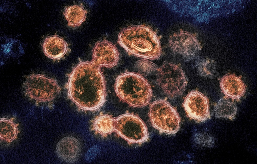 MS registra 911 casos novos de Covid-19 e já passa dos 10 mil infectados somente em fevereiro Imagens de microscópio mostram partículas do coronavírus que causam a Covid-19 retiradas de um paciente nos EUA — Foto: NIAID-RML via AP
