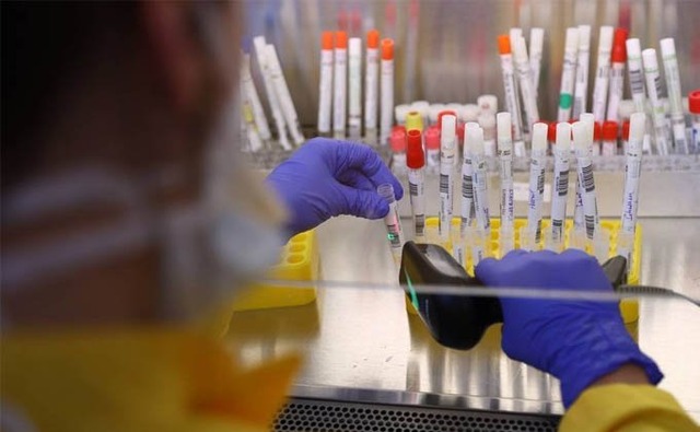Amostras de casos suspeitos para a variante do coronavírus em MS são analisadas em SP. (Foto: Reprodução)