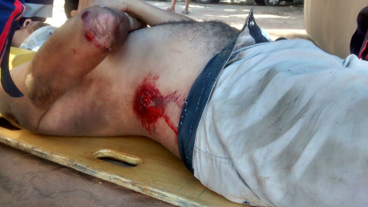 Motociclista (Foto Rádio Caçula)