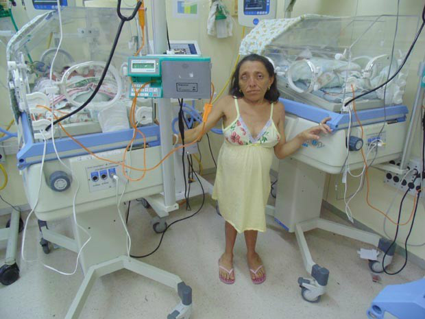 Maria Dulcinéia na UTI onde visitou as filhas Maria Eduarda e Maria Helena (Foto: Fernanda Zauli/G1)