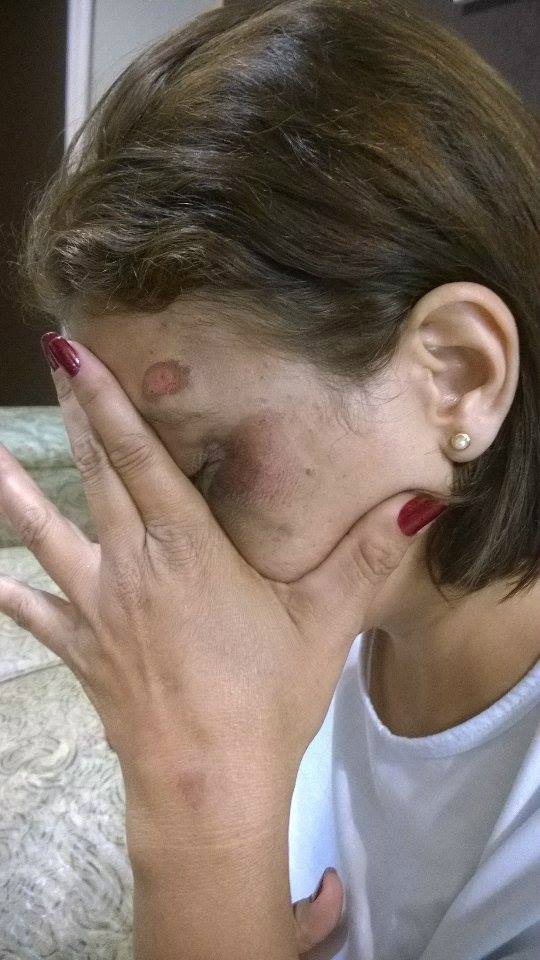 A vítima sentia fortes dores na cabeça no momento do acidente.