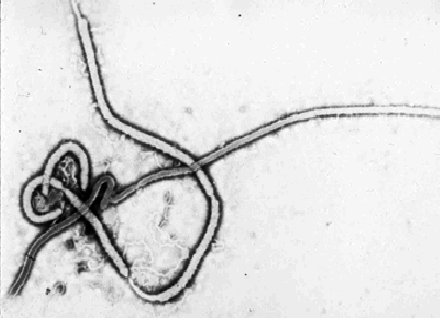 Vírus Ebola (Foto: Ilustração)