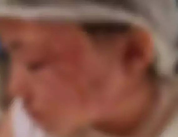 A irmão de Samantha, a menina de 9 anos, sofreu queimaduras no rosto e continua internada pela equipe de cirurgia plástica (Foto: Direto das Ruas) - CREDITO: CAMPO GRANDE NEWS