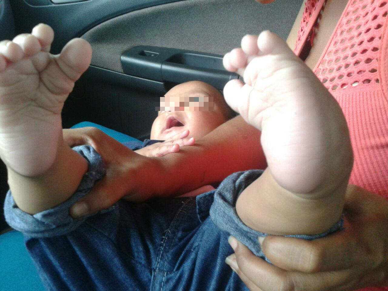 A.M de apenas 5 meses nasceu com deformidades em ambos os pés. Foto: Rádio Caçula 