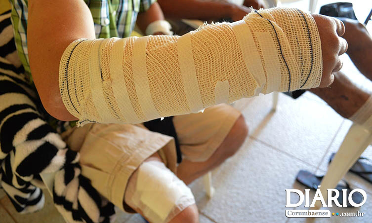 Foto: Anderson Gallo/Diário CorumbaenseOséias foi atacado ao socorrer sobrinho e levou 20 pontos no braço