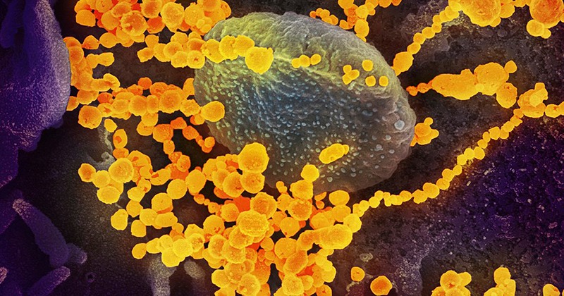 Foto: NIAID via Wikimedia Commons (CC 2.0)