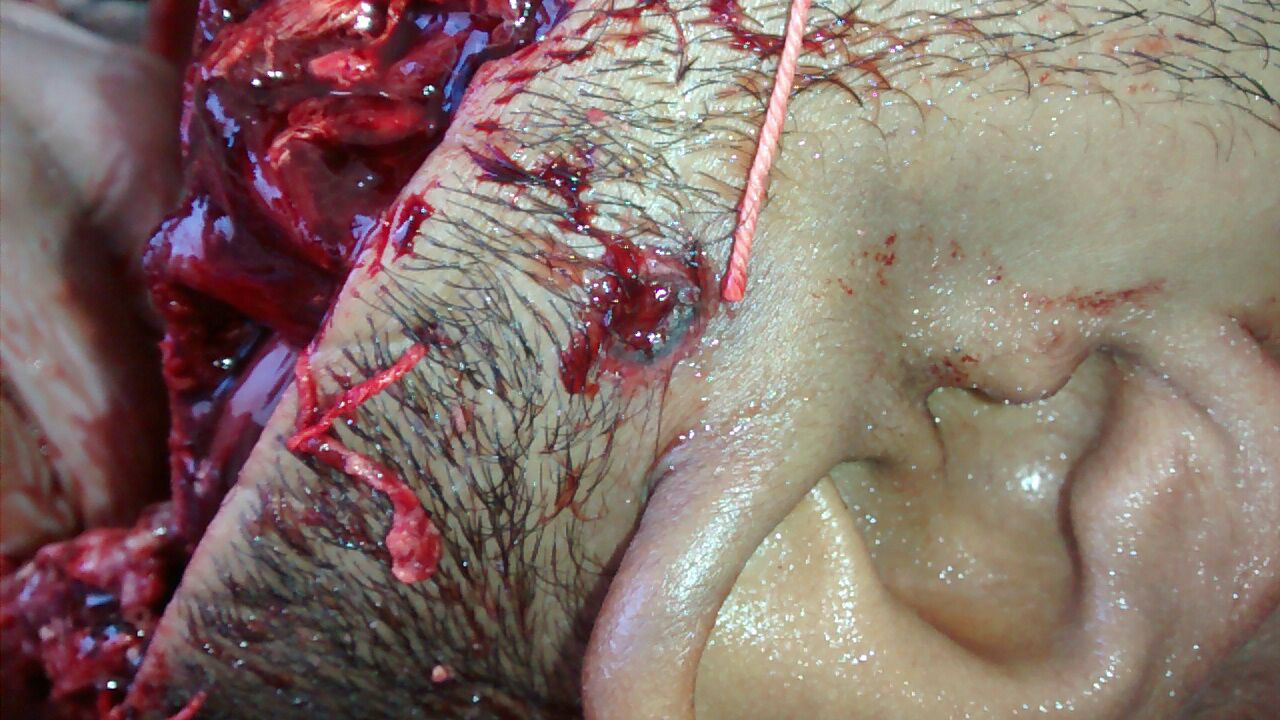 Foto: Rádio Caçula