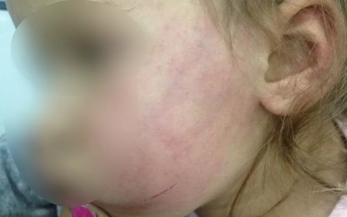 Funcionário pública admitiu, em depoimento, que agrediu a enteada (Foto: Reprodução/TV Anhanguera)