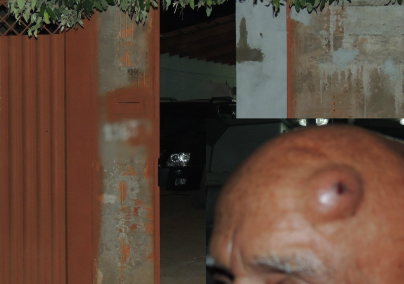 Idoso levou golpe na cabeça durante a ação dos assaltantes. Foto: Rádio Caçula