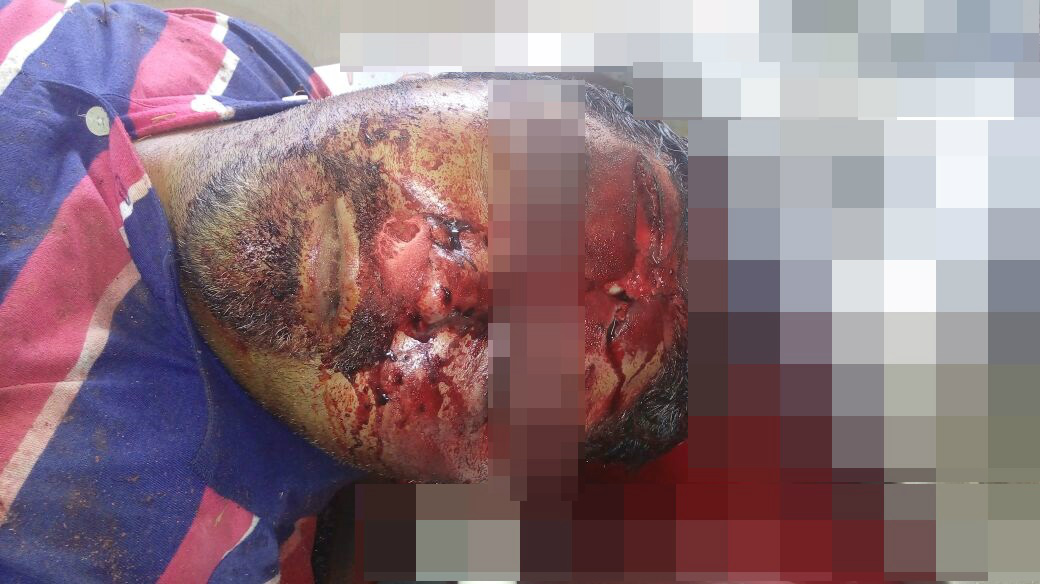 Júlio Maciel, de  39 anos foi morto cruelmente nesta madrugada (25) em Três Lagoas (MS). Foto: Rádio Caçula