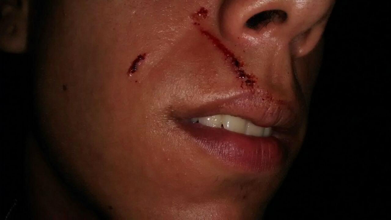 O atendente da lan que tentou apartar a briga obteve dois cortes no rosto. (Foto Rádio Caçula)