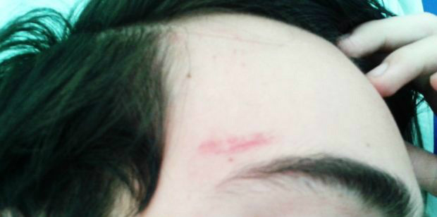 Adolescente ficou ferido após agressões cometidas pelo pai.Foto: Divulgação