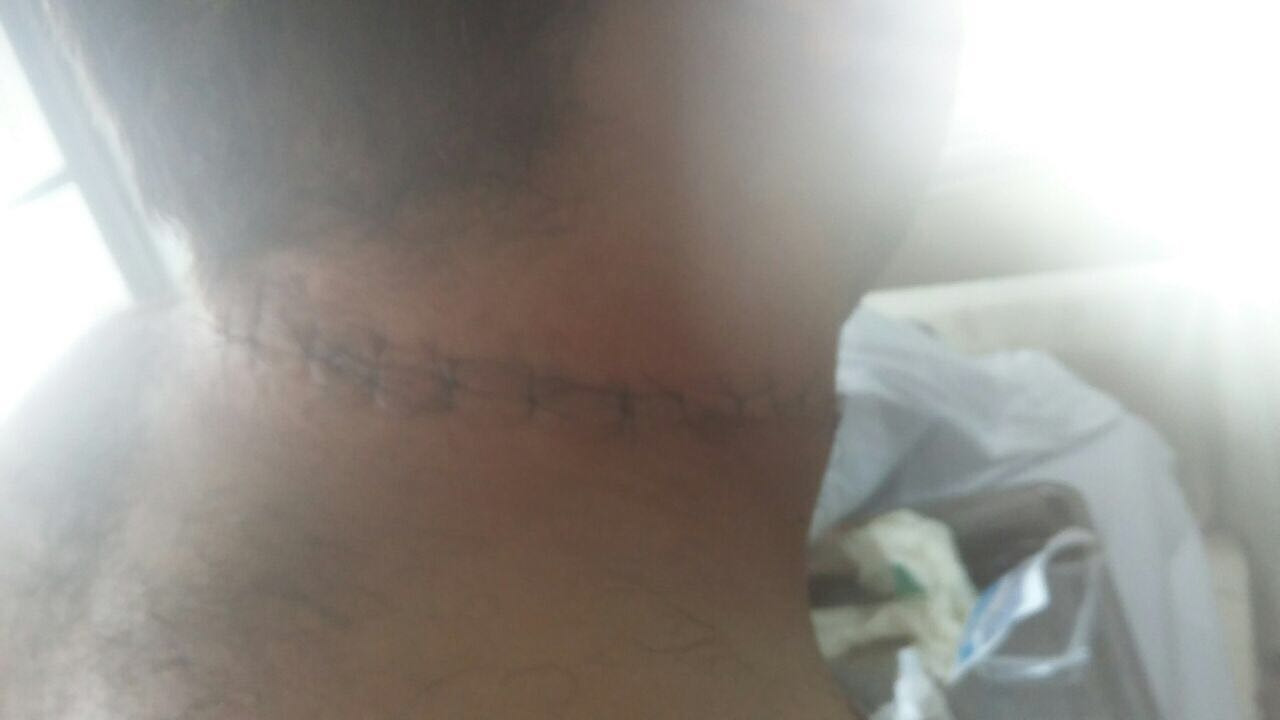 O mototaxista foi golpeado no pescoço durante o crime. 