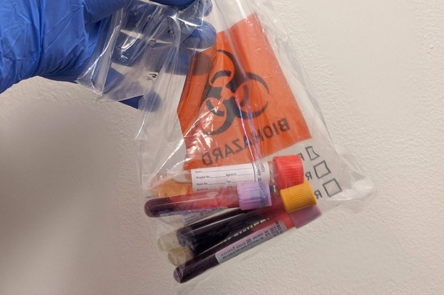 Para compartilhar esse conteúdo, por favor utilize o link https://www1.folha.uol.com.br/equilibrioesaude/2020/04/centros-de-pesquisa-do-pais-vao-estudar-transfusao-de-plasma-do-sangue-contra-a-covid-19.shtml ou as ferramentas oferecidas na página. Textos, fotos, artes e vídeos da Folha estão protegidos pela legislação brasileira sobre direito autoral. Não reproduza o conteúdo do jornal em qualquer meio de comunicação, eletrônico ou impresso, sem autorização da Folhapress (pesquisa@folhapress.com.br). As regras têm como objetivo proteger o investimento que a Folha faz na qualidade de seu jornalismo. Se precisa copiar trecho de texto da Folha para uso privado, por favor logue-se como assinante ou cadastrado.