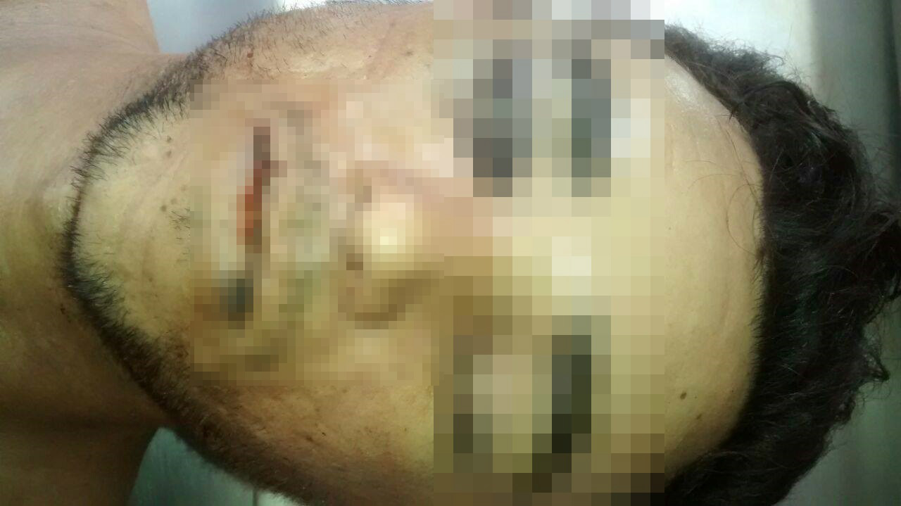 Queda de árvore mata trabalhador em Bataguassu (MS). Foto: Rádio Caçula.