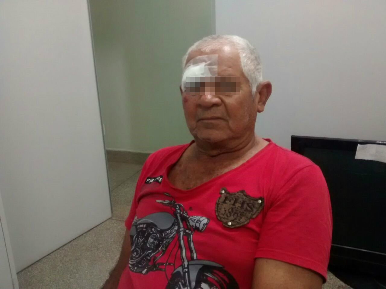 Idoso agredido (Foto Rádio Caçula)