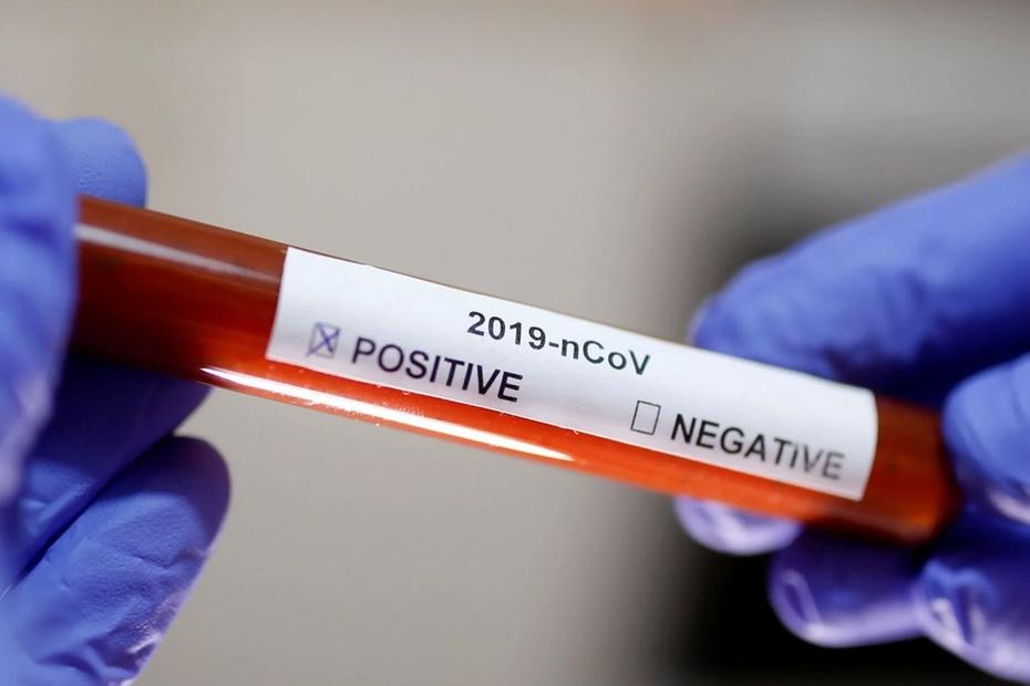 O suspeito é investigado pela Polícia Civil por ter descumprido a quarentena domiciliar. Foto: Ilustração.