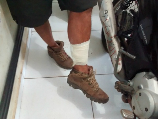 O suspeito foi alvejado na perna mas não corre de morte .Foto:Rádio Caçula